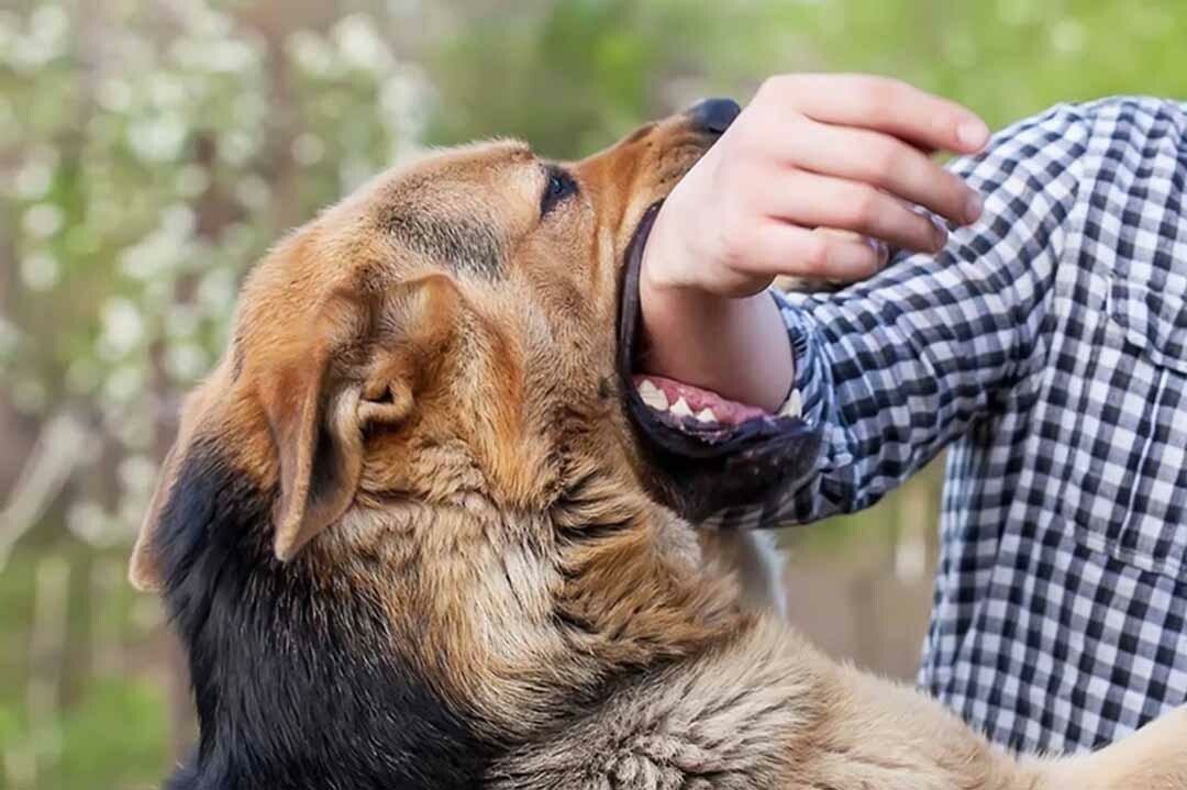 Cần theo dõi bao nhiêu ngày khi bị chó cắn?