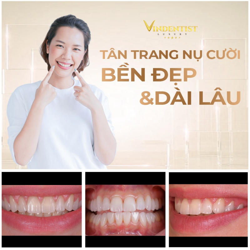 Nha khoa VIN Dentist Đà Nẵng: Bác sĩ có tâm, Phòng khám có tầm