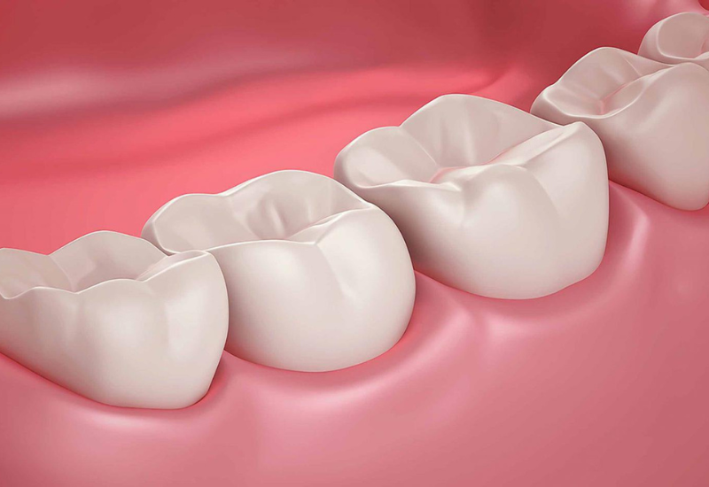Răng bị mất lâu ngày có thể thay thế được không?