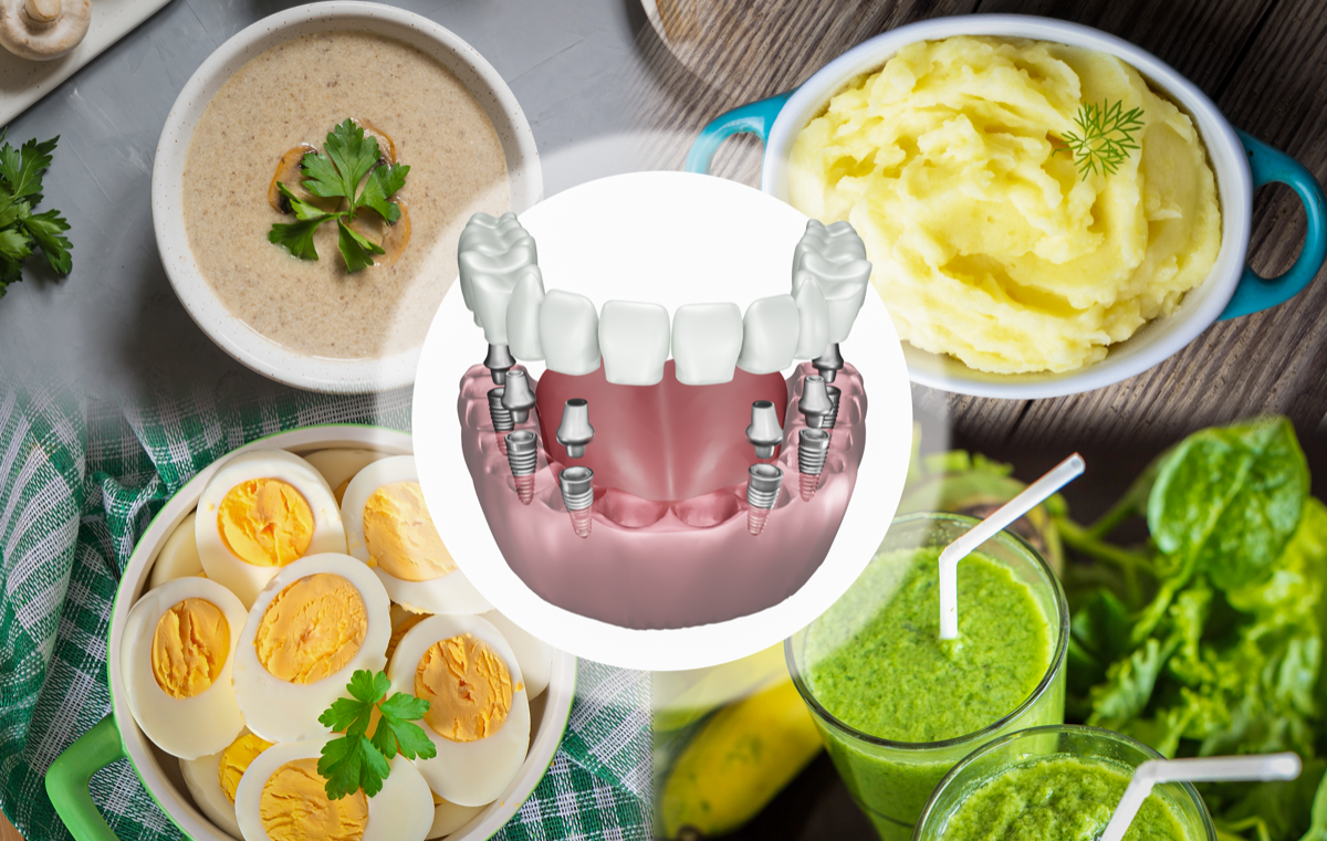 Sau khi cấy ghép implant, bệnh nhân nên ăn thức ăn mềm, lỏng, lạnh và hạn chế chất kích thích để quá trình tích hợp xương diễn ra suôn sẻ.